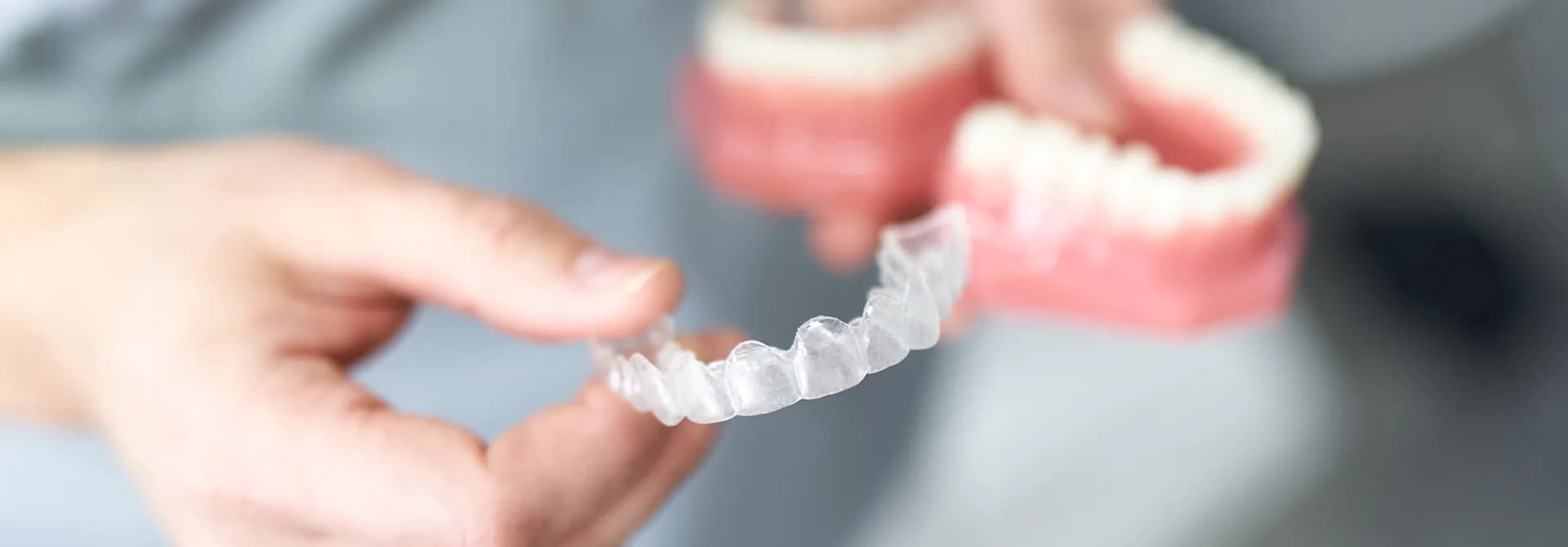 Transparente Aligner-Zahnschiene zur diskreten Zahnbegradigung